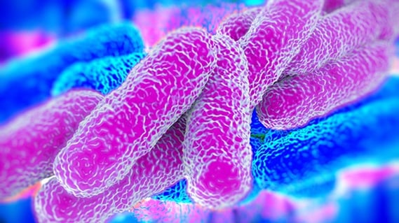 what are the risks associated with legionella and why should your clients care