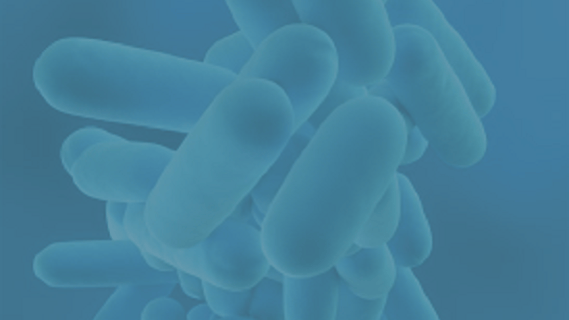 What-is-legionella-guide-for-facilities-management companies.png
