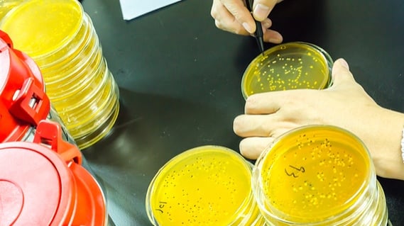 petri-dishes-with-legionella-bacteria.jpg
