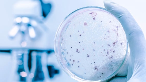 testing-legionella-using-a-petri-dish.jpg