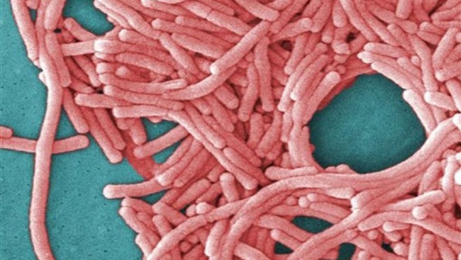 Biofilm | The Source of Legionella
